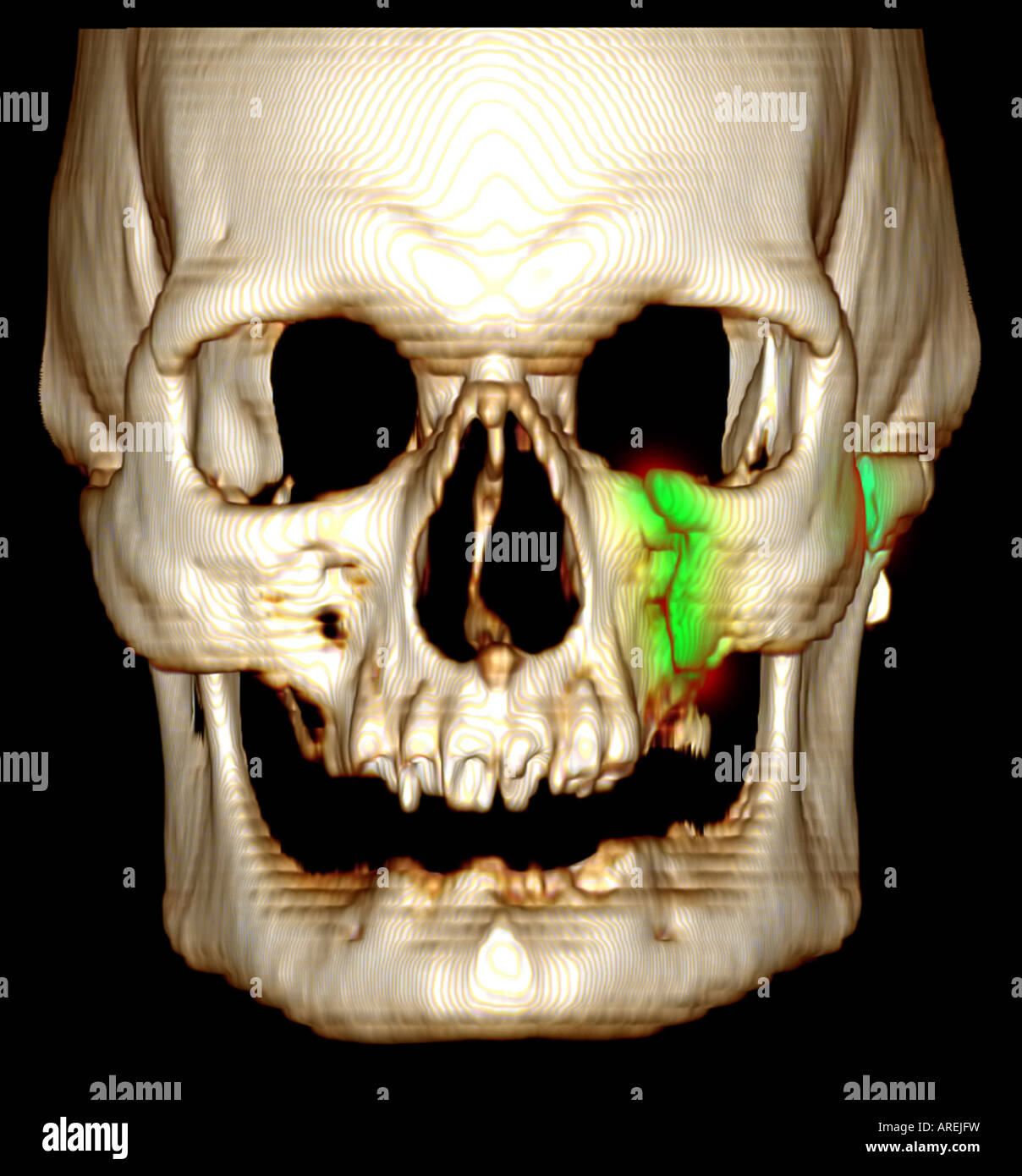 CT-Scans entdecken verstecktes Leiden bei Wikingergräbern